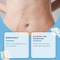 6pcs Invisible Silicone Scar Cover Patches for Scars and Tattoos, Light Beige-Tone Concealer Stickers