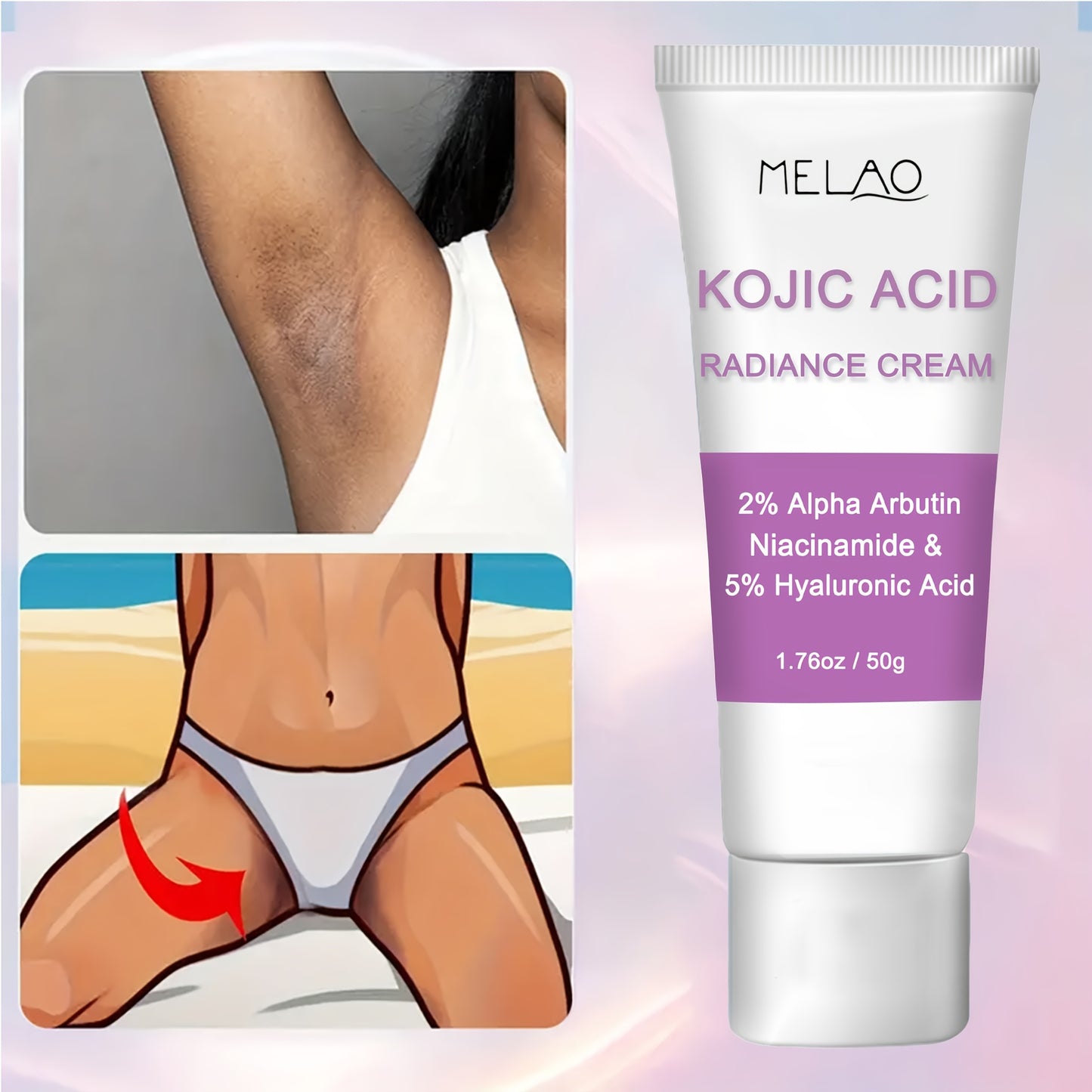 Kojic Acid Cream, Face & Body Cream with Niacinamide, ARBUTIN, Hyaluronic Acid, Shea Butter, Suitable for use on all parts of the face and body