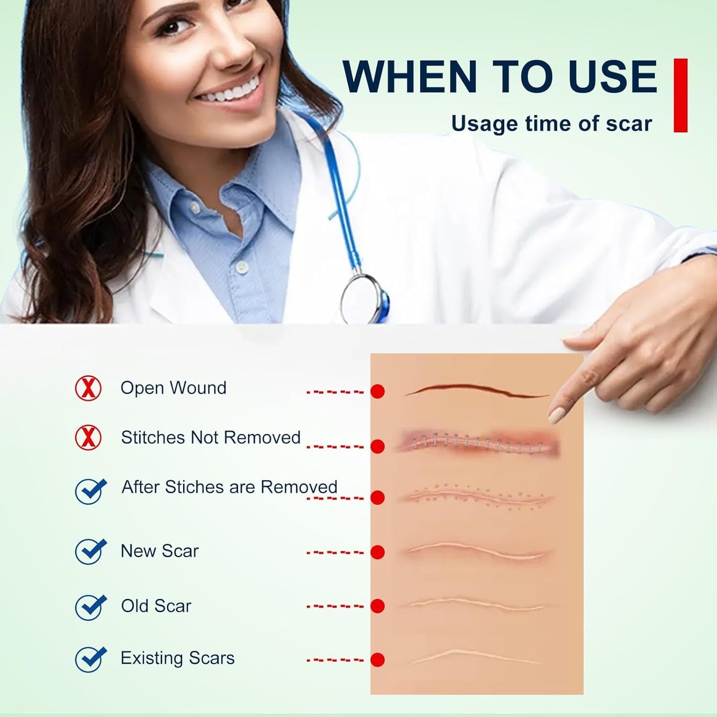 Clear Silicone Scar Sheets, Scar Away Scar Tape,