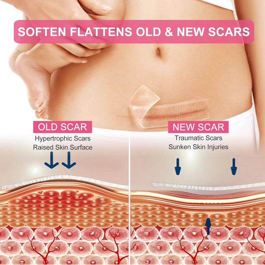 Clear Silicone Scar Sheets, Scar Away Scar Tape,