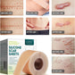 Silicone Scar Sheets (1.6” x 120”Roll-3M)
