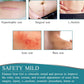ZODENIS Medical Grade Silicone Scar Sheets, Silicone Scar Tape (1.6”x 60”)