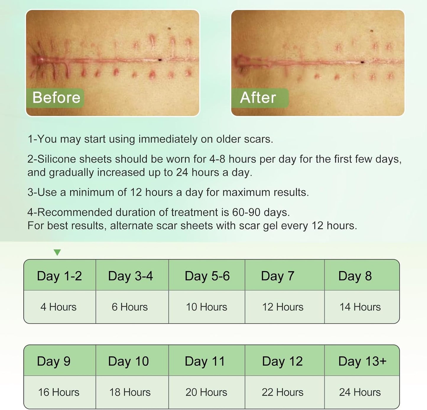Clear Silicone Scar Sheets, Scar Away Scar Tape,