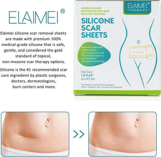 ZODENIS Medical Grade Silicone Scar Sheets, Silicone Scar Tape (1.6”x 60”)