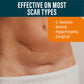 Silicone Scar Sheets - Dermatologically Tested in USA - As Surgical Cream, - 4 pack 5.7"x1.57"